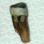 denti-devitalizzati