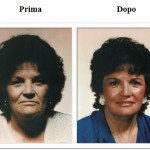 miracolo prima e dopo